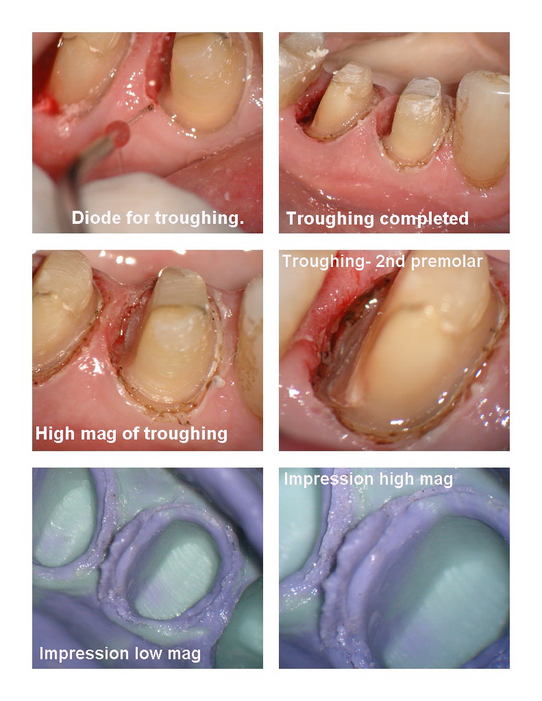 Premolar osseous pg 3.jpg